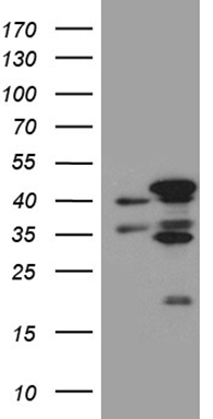 HEK293T cells were transfected with the pCMV6-ENTRY control (Left lane) or pCMV6-ENTRY FAM54A (RC213401, Right lane) cDNA for 48 hrs and lysed. Equivalent amounts of cell lysates (5 ug per lane) were separated by SDS-PAGE and immunoblotted with anti-FAM54A (1:2000). Positive lysates LY426058 (100ug) and LC426058 (20ug) can be purchased separately from OriGene.