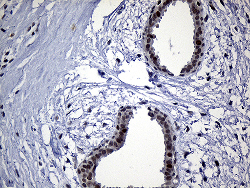 Immunohistochemical staining of paraffin-embedded Human breast tissue within the normal limits using anti-NEMF mouse monoclonal antibody. (Heat-induced epitope retrieval by 1mM EDTA in 10mM Tris buffer (pH8.5) at 120°C for 3min, TA811464) (1:250)