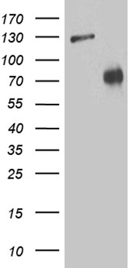 HEK293T cells were transfected with the pCMV6-ENTRY control (Left lane) or pCMV6-ENTRY ZNF572 (RC224676, Right lane) cDNA for 48 hrs and lysed. Equivalent amounts of cell lysates (5 ug per lane) were separated by SDS-PAGE and immunoblotted with anti-ZNF572 (1:2000). Positive lysates LY407580 (100ug) and LC407580 (20ug) can be purchased separately from OriGene.