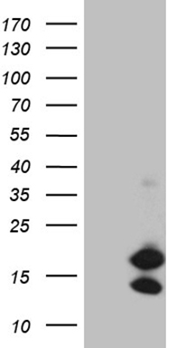 HEK293T cells were transfected with the pCMV6-ENTRY control (Left lane) or pCMV6-ENTRY E2F4 (RC207699, Right lane) cDNA for 48 hrs and lysed. Equivalent amounts of cell lysates (5 ug per lane) were separated by SDS-PAGE and immunoblotted with anti-E2F4 (1:500). Positive lysates LY400717 (100 ug) and LC400717 (20 ug) can be purchased separately from OriGene.