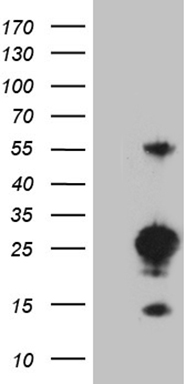 WB Suggested Anti-MYEF2 Antibody Titration: 0.2-1ug/ml; Positive Control: Jurkat cell lysate