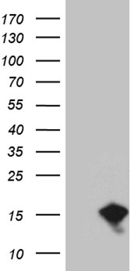 HEK293T cells were transfected with the pCMV6-ENTRY control (Left lane) or pCMV6-ENTRY EIF4EBP3 (RC210053, Right lane) cDNA for 48 hrs and lysed. Equivalent amounts of cell lysates (5 ug per lane) were separated by SDS-PAGE and immunoblotted with anti-EIF. Positive lysates LY418472 (100ug) and LC418472 (20ug) can be purchased separately from OriGene.