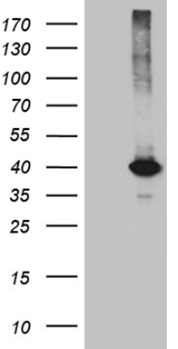 KLF7 Mouse Monoclonal Antibody [Clone ID: OTI10D1]