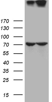 HEK293T cells were transfected with the pCMV6-ENTRY control (Left lane) or pCMV6-ENTRY BST1 (RC204151, Right lane) cDNA for 48 hrs and lysed. Equivalent amounts of cell lysates (5 ug per lane) were separated by SDS-PAGE and immunoblotted with anti-BST1. Positive lysates LY418052 (100 ug) and LC418052 (20 ug) can be purchased separately from OriGene.