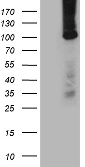 HEK293T cells were transfected with the pCMV6-ENTRY control (Left lane) or pCMV6-ENTRY CSE1L (RC211478, Right lane) cDNA for 48 hrs and lysed. Equivalent amounts of cell lysates (5 ug per lane) were separated by SDS-PAGE and immunoblotted with anti-CSE1L. Positive lysates LY420011 (100 ug) and LC420011 (20 ug) can be purchased separately from OriGene.