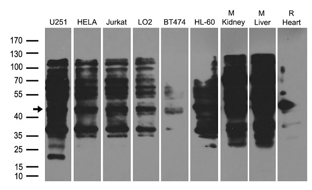 Western blot analysis of f ull length recombinant SARS-CoV-2 N protein (Cat# TP790189, 0.02 ug) by using anti-SARS-CoV-2 N protein antibody (Cat# TA814506).