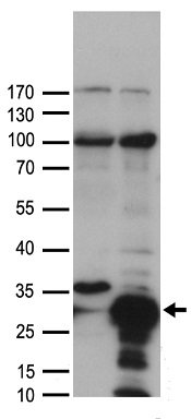 Western blot analysis of f ull length recombinant SARS-CoV-2 N protein (Cat# TP790189, 0.02 ug) by using anti-SARS-CoV-2 N protein antibody (Cat# TA814507).