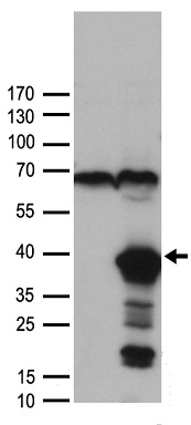 Western blot analysis of f ull length recombinant SARS-CoV-2 N protein (Cat# TP790189, 0.02 ug) by using anti-SARS-CoV-2 N protein antibody (Cat# TA814510).