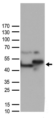 SARS-Cov-2 RBD neutralizing antibody (Cat# TA814512) inhibits human ACE2 protein (Cat# TP701115) binding to SARS-CoV-2 RBD protein TP701119). The IC50 is typically 0.91 nM.