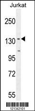 PPP1R3A Antibody (Center) (Cat. #TA324365) western blot analysis in Jurkat cell line lysates (35ug/lane).This demonstrates the PPP1R3A antibody detected the PPP1R3A protein (arrow).