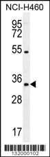 PURB Antibody (C-term) (Cat. #TA324468) western blot analysis in NCI-H460 cell line lysates (35ug/lane).This demonstrates the PURB antibody detected the PURB protein (arrow).