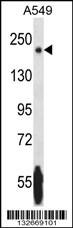 NRK Antibody (Center) (Cat. #TA324519) western blot analysis in A549 cell line lysates (35ug/lane).This demonstrates the NRK antibody detected the NRK protein (arrow).