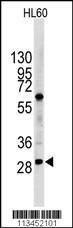 Western blot analysis of LIN28B Antibody (N-term) (Cat.#TA324574) in HL60 cell line lysates (35ug/lane). LIN28B (arrow) was detected using the purified Pab.