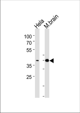 WB Suggested Anti-Atp1b2 Antibody Titration: 0.2-1ug/ml ELISA Titer: 1:62500 Positive Control: Mouse Kidney