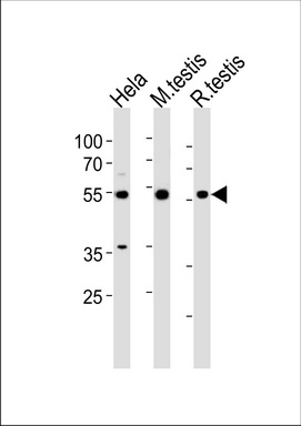 WB Suggested Anti-ACP2 Antibody Titration: 0.2-1ug/ml ELISA Titer: 1:62500 Positive Control: Human brain