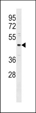 ONECUT3 Antibody (C-term) (Cat. #TA324627) western blot analysis in MDA-MB231 cell line lysates (35ug/lane).This demonstrates the ONECUT3 antibody detected the ONECUT3 protein (arrow).