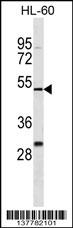 ZNF187 Antibody (N-term) (Cat. #TA324628) western blot analysis in HL-60 cell line lysates (35ug/lane).This demonstrates the ZNF187 antibody detected the ZNF187 protein (arrow).