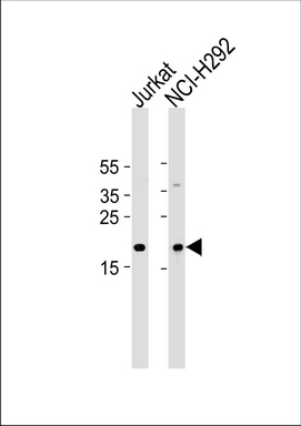 WB Suggested Anti-PCDH1 Antibody Titration: 0.2-1ug/ml ELISA Titer: 1:312500 Positive Control: MCF7 cell lysate