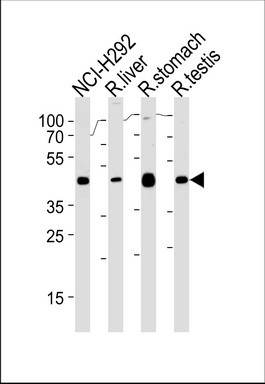 PCGF6 Antibody (Center) (Cat.# TA324658) western blot analysis in NCI-H292, rat liver, stomach and testis cell line lysates (35ug/lane).This demonstrates the PCGF6 antibody detected the PCGF6 protein (arrow).