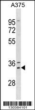 MSX1 Antibody (Center) (Cat. #TA324668) western blot analysis in A375 cell line lysates (35ug/lane).This demonstrates the MSX1 antibody detected the MSX1 protein (arrow).