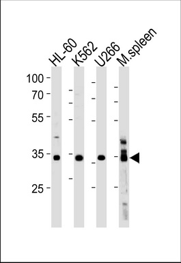 GFI1B Antibody (C-term) (Cat. #TA325150) western blot analysis in HL-60, K562, U266
