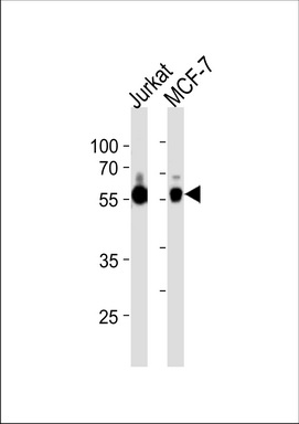 ZNF434 Antibody (Center) (Cat. #TA325152) western blot analysis in Jurkat, MCF-7 cell line lysates (35ug/lane).This demonstrates the ZNF434 antibody detected the ZNF434 protein (arrow).
