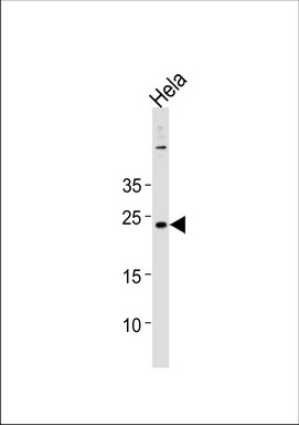 CNO Antibody (Center) (Cat. #TA325127) western blot analysis in Hela cell line lysates (35ug/lane).This demonstrates the CNO antibody detected the CNO protein (arrow).