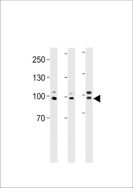 EPC1 Antibody (Center) (Cat. #TA325090) western blot analysis in A2058, Hela cell line and mouse heart tissue lysates (35ug/lane).This demonstrates the EPC1 antibody detected the EPC1 protein (arrow).