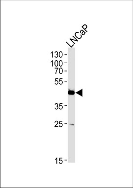 FAM54A Antibody (C-term) (Cat. #TA328187) western blot analysis in LNCaP cell line lysates (35ug/lane).This demonstrates the FAM54A antibody detected the FAM54A protein (arrow).