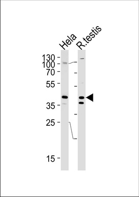 KHDRBS2 Antibody (C-term) (Cat. #TA328133) western blot analysis in Hela cell line and rat testis tissue lysates (35ug/lane).This demonstrates the KHDRBS2 antibody detected the KHDRBS2 protein (arrow).