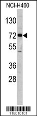 Western blot analysis of ELP2 antibody (C-term) (Cat. #TA324752) in NCI-H460 cell line lysates (35ug/lane). ELP2 (arrow) was detected using the purified Pab.