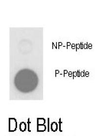 Western blot analysis of extracts of various cell lines, using SETD3 antibody (TA381409) at 1:1000 dilution.|Secondary antibody: HRP Goat Anti-Rabbit IgG (H+L) at 1:10000 dilution.|Lysates/proteins: 25ug per lane.|Blocking buffer: 3% nonfat dry milk in TBST.|Detection: ECL Basic Kit .|Exposure time: 30s.