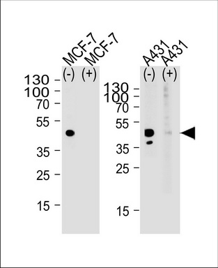 Western blot analysis of lysate from MCF-7, A431 cell line, using CALCR Antibody (C-term) (Cat. #TA324814) with (+) or without (-) peptides. TA324814 was diluted at 1:1000 at each lane. A goat anti-rabbit (HRP) at 1:5000 dilution was used as the secondary antibody. Lysate at 35ug per lane.