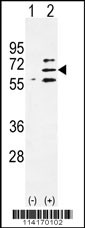 Western blot analysis of Parp6 (arrow) using rabbit polyclonal Parp6 Antibody (C-term) (Cat. #TA302167). 293 cell lysates (2 ug/lane) either nontransfected (Lane 1) or transiently transfected (Lane 2) with the Parp6 gene.