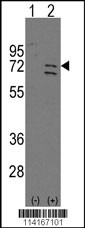 Western blot analysis of Parp6 (arrow) using rabbit polyclonal Parp6 Antibody (C-term) (Cat.#TA302166). 293 cell lysates (2 ug/lane) either nontransfected (Lane 1) or transiently transfected with the Parp6 gene (Lane 2) (Origene Technologies).