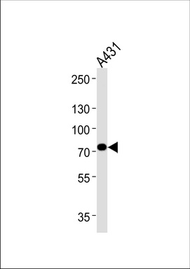 WB Suggested Anti-pb Antibody Titration: 0.2-1ug/ml Positive Control: Drosophila