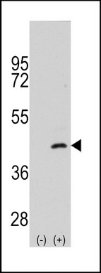 Western blot analysis of MAP2K4 (arrow) using rabbit polyclonal MAP2K4 Antibody (S257) (Cat.#TA300116).293 cell lysates (2 ug/lane) either nontransfected (Lane 1) or transiently transfected with the MAP2K4 gene (Lane 2) (Origene Technologies).
