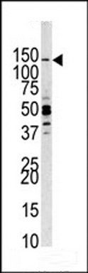 WB Suggested Anti-SMYD3 Antibody Titration: 0.2-1ug/ml; ELISA Titer: 1: 312500; Positive Control: Human Stomach