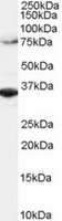 TA302714 (2ug/ml) staining of Hela lysate (RIPA buffer, 1.4E5 cells per lane). Detected by western blot using chemiluminescence.