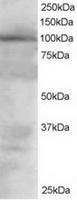 TA302768 staining (1.5ug/ml) of 293 lysate (RIPA buffer, 30ug total protein per lane). Primary incubated for 1 hour. Detected by western blot using chemiluminescence.
