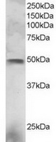 TA302473 staining (3ug/ml) of NCI-H460 lysate (RIPA buffer, 30ug total protein per lane). Primary incubated for 1 hour. Detected by western blot using chemiluminescence.