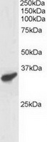 TA302854 staining (1ug/ml) of Human Heart lysate (RIPA buffer, 30ug total protein per lane). Primary incubated for 1 hour. Detected by western blot using chemiluminescence.