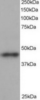 TA302940 staining (1ug/ml) of human heart lysate (RIPA buffer, 35ug total protein per lane). Primary incubated for 1 hour. Detected by western blot using chemiluminescence.