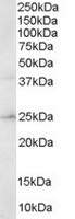 TA302984 staining (0.3ug/ml) of Human Brain lysate (RIPA buffer, 30ug total protein per lane). Primary incubated for 1 hour. Detected by western blot using chemiluminescence.
