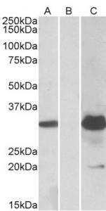 HEK293 lysate (10ug protein in RIPA buffer) overexpressing Human KCTD11 with DDK (FLAG) tag probed with TA311151 (1.0ug/ml) in Lane A and probed with anti-DDK Tag (1:5000, Cat# TA50011-100) in Lane C. Mock-transfected HEK293 probed with TA311151 (1mg/ml) in Lane B. Primary incubations were for 1 hour. Detected by chemiluminescence.