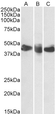 Gel: 8%SDS-PAGE<br>Lysate: 40 μg<br>Lane 1-2: Human fetal brain tissue<br>mouse brain tissue<br>Primary antibody: TA364762 (MAPRE3 Antibody) at dilution 1/500<br>Secondary antibody: Goat anti rabbit IgG at 1/8000 dilution<br>Exposure time: 5 seconds