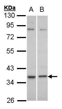 Sample (30 ug of whole cell lysate). A: HeLa. B: Molt-4. 10% SDS PAGE. TA308708 diluted at 1:1000