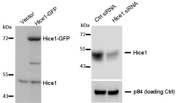 WB to detect cellular Hice1 and Hice1-GFP expressed in human osteosarcoma U2OS cells (left image), and Hice1 upon siRNA treatment (right image), using TA307936 at 1:1000 dilution. Nuclear matrix protein p84 is a loading control, blotted with p84 antibody