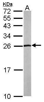 WB Suggested Anti-PPP1R12A Antibody; Titration: 1.0ug/ml; Positive Control: Jurkat Whole Cell There is BioGPS gene expression data showing that PPP1R12A is expressed in Jurkat