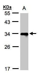 Sample (30 ug whole cell lysate). A:Raji. 12% SDS PAGE. TA308898 diluted at 1:1000